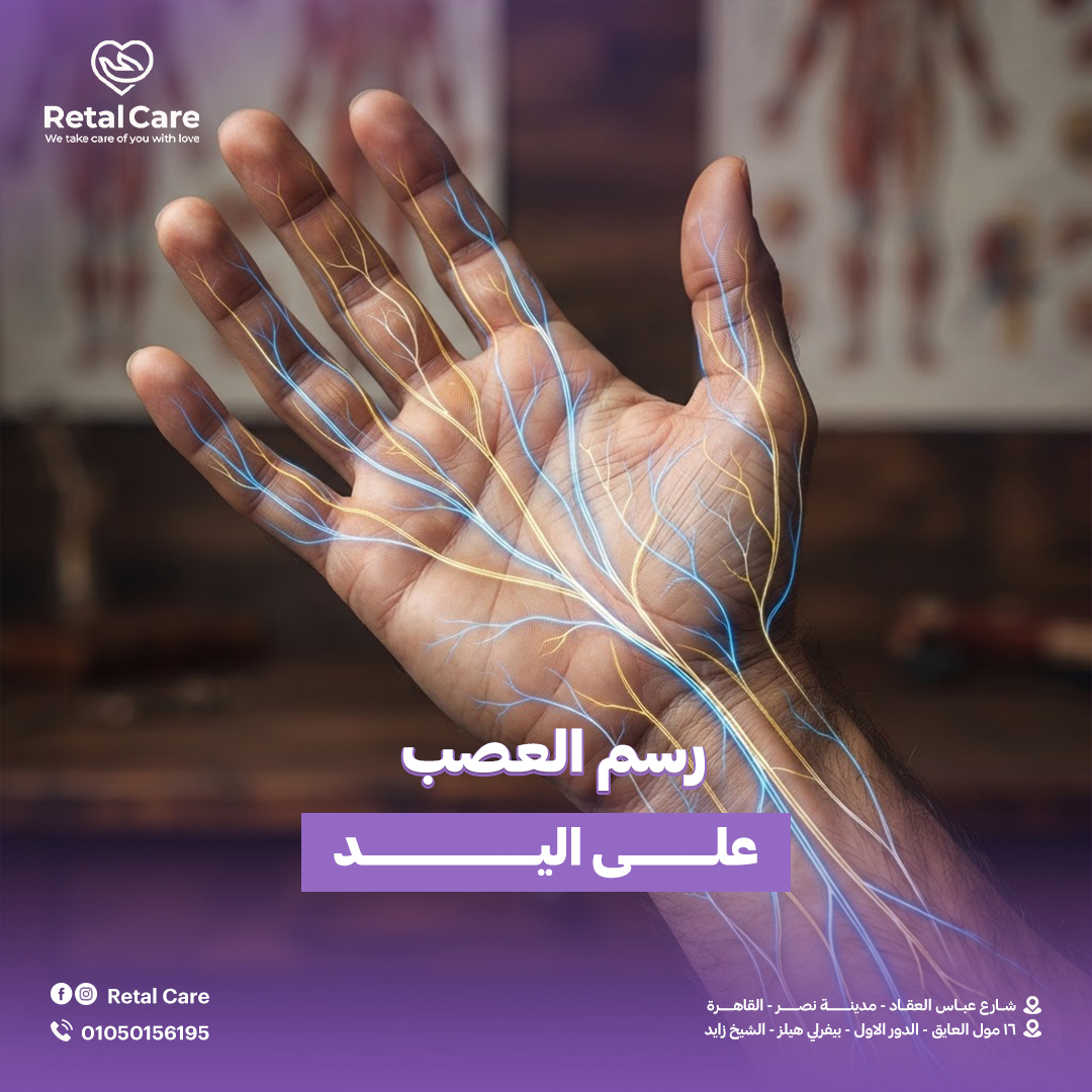 رسم العصب على اليد