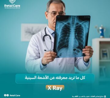 الأشعة السينية