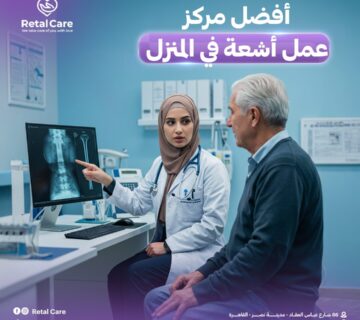 أفضل مركز عمل أشعة في المنزل