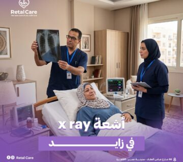 أشعة x ray في زايد