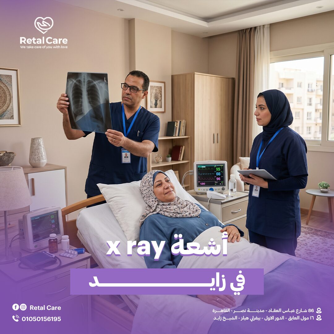 أشعة x ray في زايد
