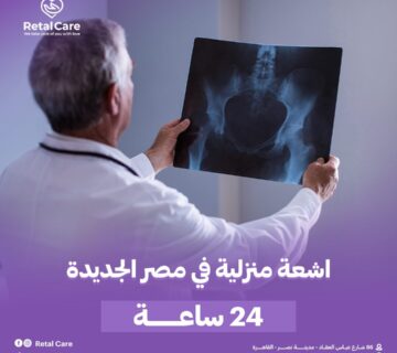 اشعه منزليه في مصر الجديده 24 ساعه