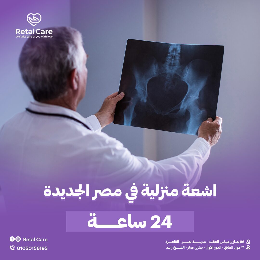 اشعه منزليه في مصر الجديده 24 ساعه