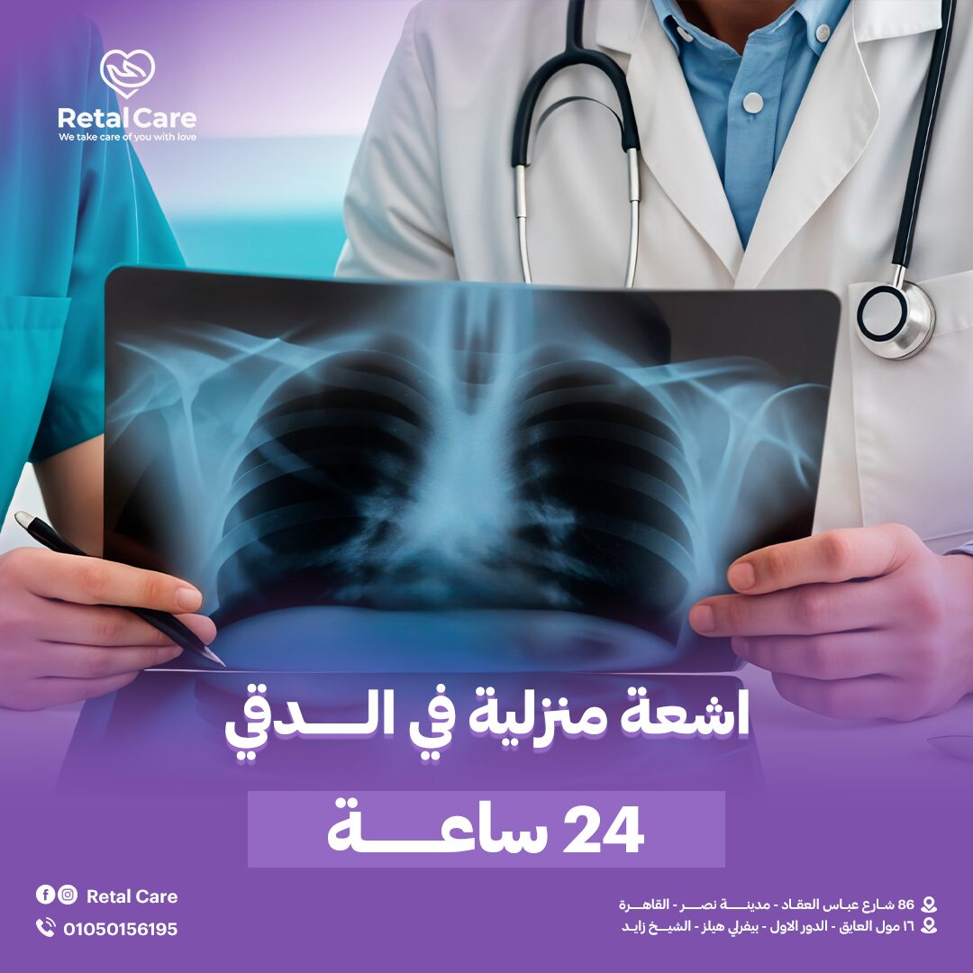 اشعه منزليه في الدقي 24 ساعه