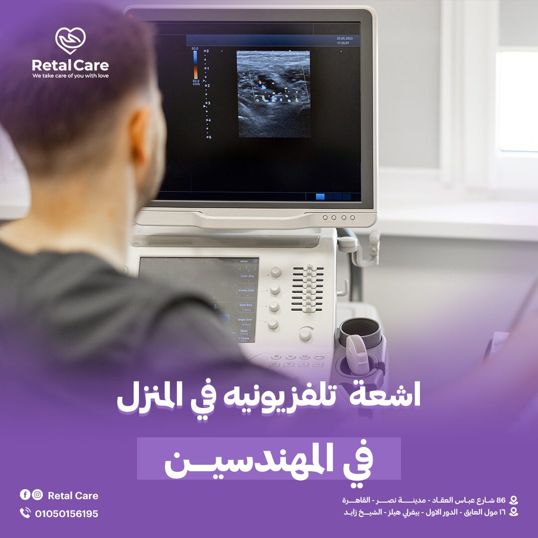 اشعه تلفزيونيه في المنزل ف المهندسين