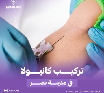 تركيب كانيولا في مدينه نصر