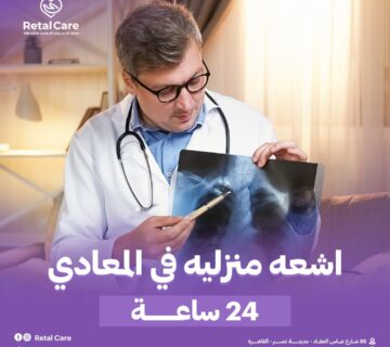 اشعه منزليه في المعادي 24 ساعه