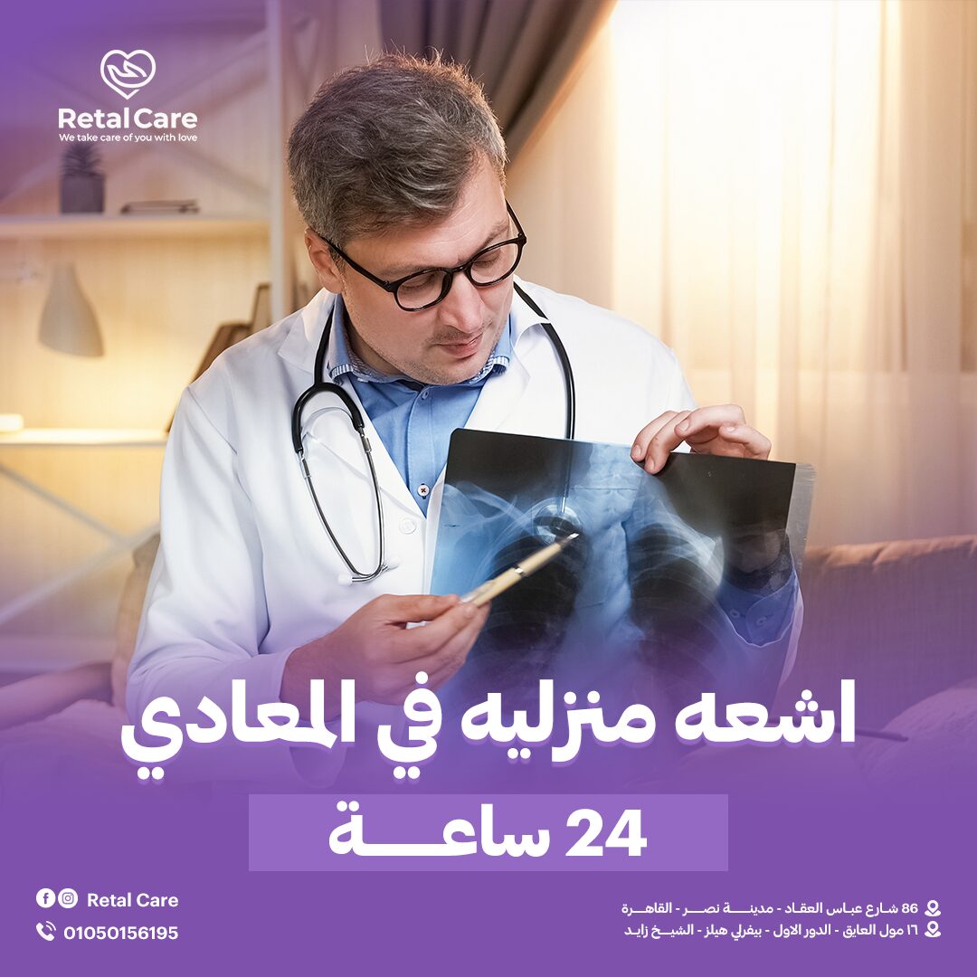 اشعه منزليه في المعادي 24 ساعه