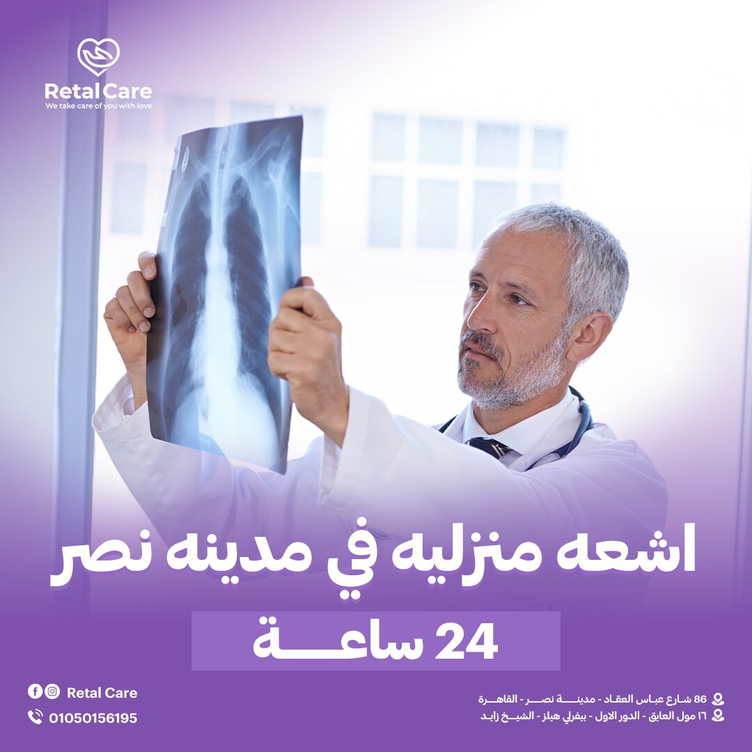 اشعه منزليه في مدينه نصر 24 ساعه