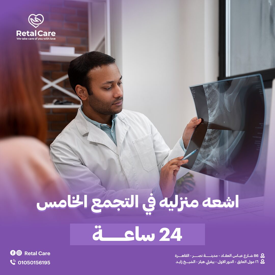 اشعه منزليه في التجمع الخامس 24 ساعه