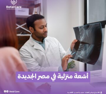 أشعة منزلية في مصر الجديدة