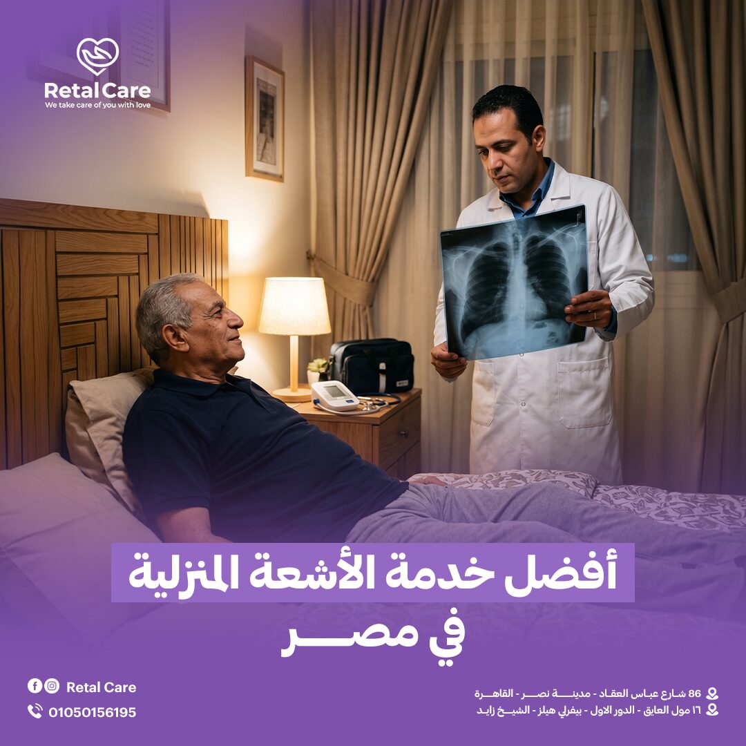 أفضل خدمة الأشعة المنزلية في مصر