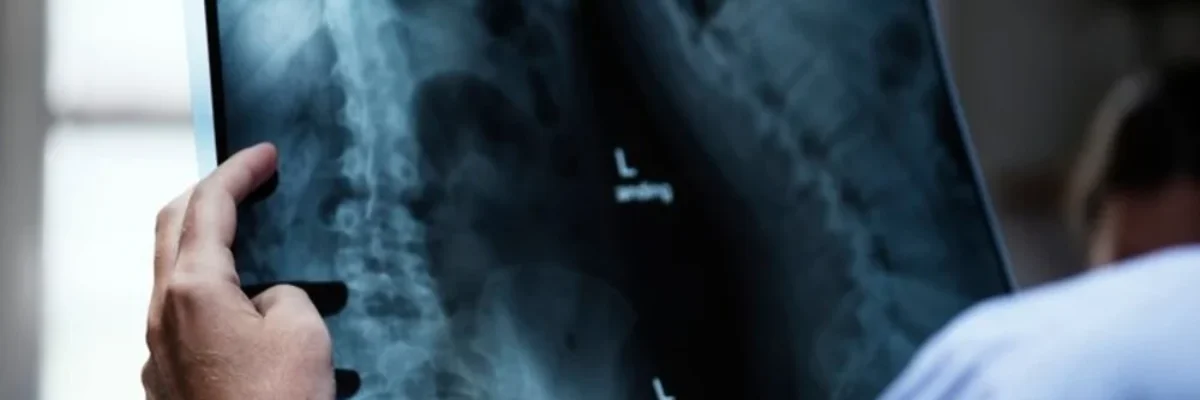 أشعة x-ray فحص منزلي