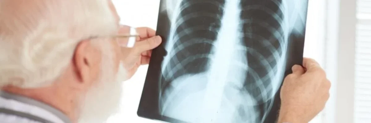 فحص اشعة x-ray